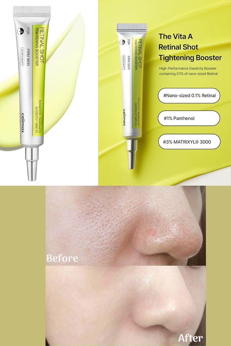 Celimax Retinol Shot Tightening Serum – Firm, Smooth & Youthful Skin